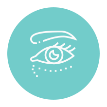 transconjunctival incisions icon