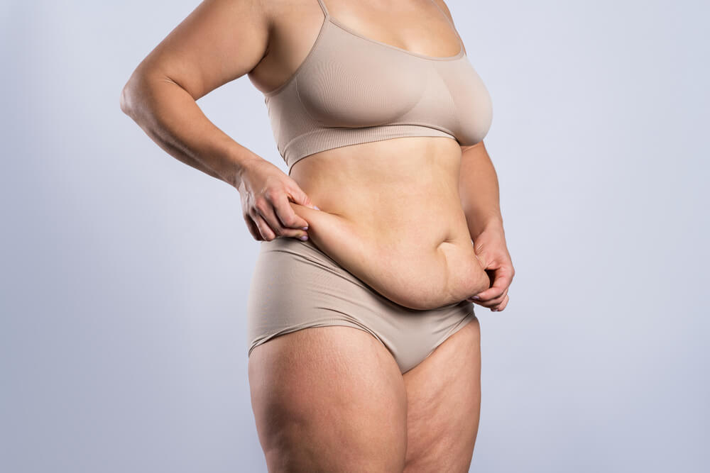 Tummy Tuck, Flabby Skin on a Fat Belly, Plastic Surgery Concept on Gray Background
